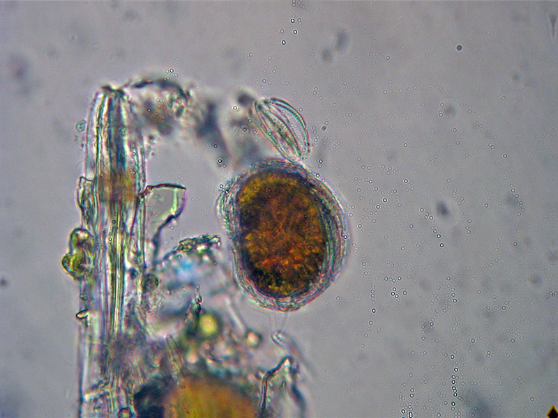 Dinoflagellato ?